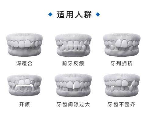 手机内存卡是tf卡还是sd卡